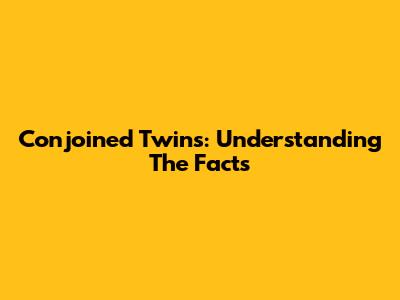 Conjoined Twins: Understanding The Facts