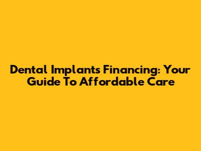 Dental Implants Financing: Your Guide To Affordable Care