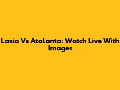 Lazio Vs Atalanta: Watch Live With Images