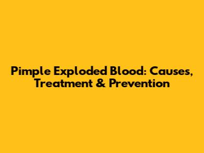Pimple Exploded Blood: Causes, Treatment & Prevention