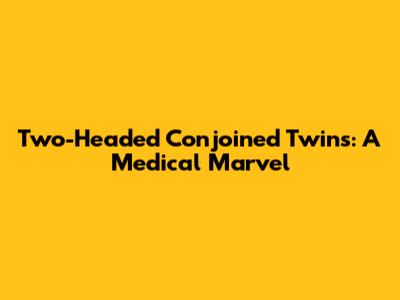 Two-Headed Conjoined Twins: A Medical Marvel